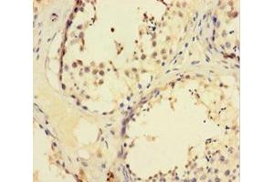 Immunohistochemistry of paraffin-embedded human testis tissue using ABIN7176122 at dilution of 1:100 (ZNF165 antibody  (AA 1-485))