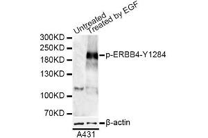 Western blot analysis of extracts of A-431 cells, using Phospho-ERBB4-Y1284 antibody (ABIN5969891) at 1/1000 dilution. (ERBB4 antibody  (pTyr1284))