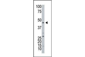 Western blot analysis of ART3 Antibody (C-term) in HL60 cell line lysates (25 μg/lane). (ART3 antibody  (C-Term))