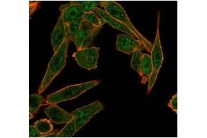 Immunofluorescence (IF) image for anti-Histone Deacetylase 6 (HDAC6) antibody (ABIN7504168)