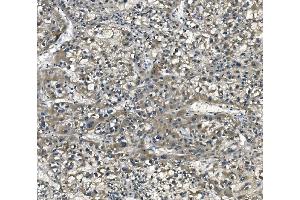 IHC analysis of eRF1/ETF1 using anti-eRF1/ETF1 antibody (ABIN7602626). (ETF1 antibody  (AA 9-342))