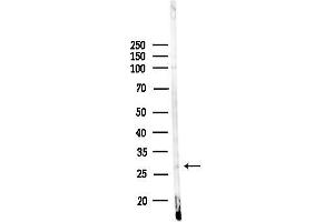 anti-Homeobox D12 (HOXD12) (Internal Region) antibody
