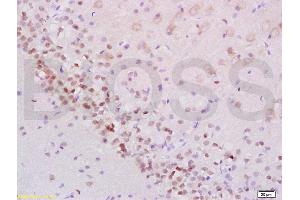 Formalin-fixed and paraffin embedded rat brain labeled with Anti-Phospho-Stat2 (Tyr690) Polyclonal Antibody, Unconjugated (ABIN746183) at 1:200 followed by conjugation to the secondary antibody and DAB staining