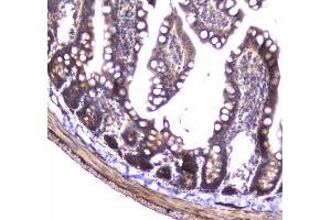 IHC analysis of 14-3-3 zeta/delta using anti-14-3-3 zeta/delta antibody . (14-3-3 zeta antibody)