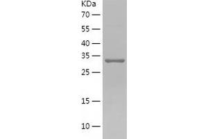 RCN1 Protein (AA 30-331) (His tag)