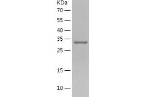 Western Blotting (WB) image for Reticulocalbin 1, EF-Hand Calcium Binding Domain (RCN1) (AA 30-331) protein (His tag) (ABIN7124833) (RCN1 Protein (AA 30-331) (His tag))