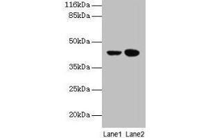 Western blot All lanes: CCR6 antibody at 10 μg/mL Lane 1: MCF-7 whole cell lysate Lane 2: Hela whole cell lysate Secondary Goat polyclonal to rabbit IgG at 1/10000 dilution Predicted band size: 43 kDa Observed band size: 43 kDa (CCR6 antibody  (AA 322-374))