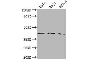 Western Blot Positive WB detected in: Hela whole cell lysate, Raji whole cell lysate, MCF-7 whole cell lysate All lanes: AGTR1 antibody at 1:2000 Secondary Goat polyclonal to rabbit IgG at 1/50000 dilution Predicted band size: 42 kDa Observed band size: 42 kDa (Recombinant Angiotensin II Type-1 Receptor antibody)