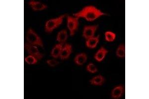 Immunofluorescent analysis of MBTPS1 staining in SKOV3 cells. (MBTPS1 antibody)