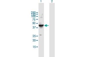 Western Blot analysis of FLOT2 expression in transfected 293T cell line by FLOT2 MaxPab polyclonal antibody. (Flotillin 2 antibody  (AA 1-379))