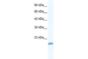WB Suggested Anti-EDF1 Antibody Titration:  1. (EDF1 antibody  (N-Term))