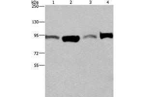 Western Blot analysis of A375 and LoVo cell, Human testis tissue and Hela cell using ELAC2 Polyclonal Antibody at dilution of 1:250 (ELAC2 antibody)