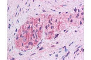 WNT5A antibody was used for immunohistochemistry at a concentration of 4-8 ug/ml. (WNT5A antibody  (Middle Region))