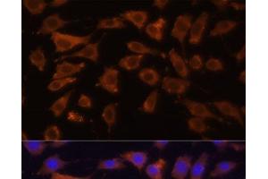 Immunofluorescence analysis of L929 cells using DCN Polyclonal Antibody at dilution of 1:100 (40x lens). (Decorin antibody)