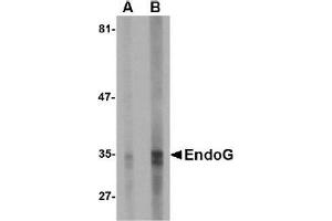 Western Blotting (WB) image for anti-Endonuclease G (ENDOG) (AA 51-140) antibody (ABIN492522) (Endonuclease G antibody  (AA 51-140))