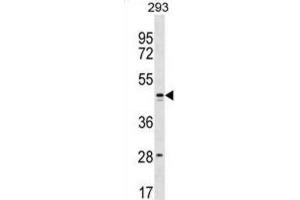 Western Blotting (WB) image for anti-Family with Sequence Similarity 155, Member B (FAM155B) antibody (ABIN3000232)