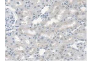 Detection of CES1 in Rat Kidney Tissue using Polyclonal Antibody to Carboxylesterase 1 (CES1) (CES1 antibody  (AA 19-300))