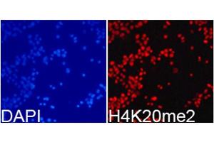 Immunofluorescence analysis of 293T cells using DiMethyl-Histone H4-K20 antibody. (Histone H4 antibody  (2meLys20))