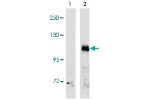 Western blot analysis of EPHA3 (arrow) using EPHA3 polyclonal antibody . (EPH Receptor A3 antibody  (C-Term))