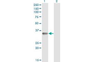 Western Blot analysis of RNF212 expression in transfected 293T cell line by RNF212 monoclonal antibody (M01), clone 5H3. (RNF212 antibody  (AA 133-232))