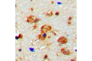 Immunohistochemical analysis of CaMK2 beta/gamma (pT287) staining in human brain formalin fixed paraffin embedded tissue section. (CaMK2 beta/gamma antibody  (pSer287))