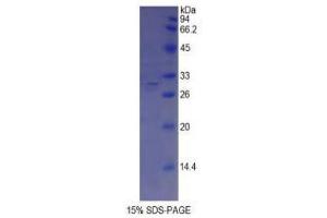SDS-PAGE (SDS) image for ATP-Binding Cassette, Sub-Family A (ABC1), Member 1 (ABCA1) (AA 1404-1663) protein (His tag) (ABIN2120623)