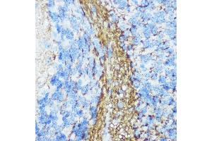 Immunohistochemistry of paraffin-embedded mouse brain using Neurofilament M Rabbit pAb (ABIN7268865) at dilution of 1:100 (40x lens). (NEFM antibody  (AA 200-300))