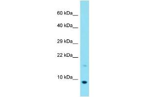 Host: Rabbit Target Name: C20orf166 Sample Type: MCF7 Whole Cell lysates Antibody Dilution: 1. (C20orf166 antibody  (C-Term))