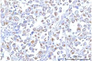 IHC analysis of PTPIP51/RMDN3 using anti-PTPIP51/RMDN3 antibody (ABIN7601775). (RMDN3 antibody  (AA 45-438))