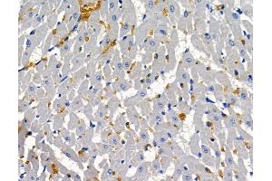 ABIN7096996 and ABIN7101063 at 1/100 staining rat heart tissue by IHC-P.