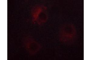 ABIN6267378 staining RL cells by ICC/IF. (NCF1 antibody  (pSer359))