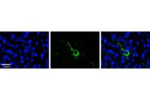 Rabbit Anti-LPIN1 Antibody  Catalog Number: ARP53826_P050  Formalin Fixed Paraffin Embedded Tissue: Human Pineal Tissue  Observed Staining: Cytoplasmic and membrane in cell bodies and processes of pinealocytes  Primary Antibody Concentration: 1:100  Other Working Concentrations: 1/600  Secondary Antibody: Donkey anti-Rabbit-Cy3  Secondary Antibody Concentration: 1:200  Magnification: 20X  Exposure Time: 0. (Lipin 1 antibody  (N-Term))