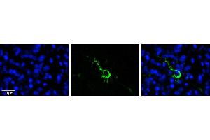 Rabbit Anti-LPIN1 Antibody  Catalog Number: ARP53826_P050  Formalin Fixed Paraffin Embedded Tissue: Human Pineal Tissue  Observed Staining: Cytoplasmic and membrane in cell bodies and processes of pinealocytes  Primary Antibody Concentration: 1:100  Other Working Concentrations: 1/600  Secondary Antibody: Donkey anti-Rabbit-Cy3  Secondary Antibody Concentration: 1:200  Magnification: 20X  Exposure Time: 0.