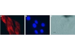 Expression of CNTF in rat C6 glioma cells - Immunocytochemical staining of fixed and permeabilized rat C6 glioma cells. (CNTF antibody  (AA 164-177))