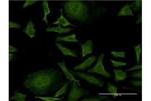 Immunofluorescence of monoclonal antibody to ISCU on HeLa cell. (ISCU antibody  (AA 26-167))