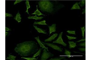Immunofluorescence of monoclonal antibody to ISCU on HeLa cell. (ISCU antibody  (AA 26-167))