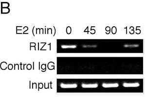 ChIP analysis of estrogen target genes. (PRDM2 antibody  (AA 1-347))