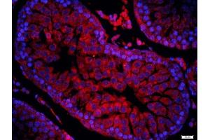Paraformaldehyde-fixed, paraffin embedded rat testis tissue, Antigen retrieval by boiling in sodium citrate buffer(pH6) for 15min, Block endogenous peroxidase by 3% hydrogen peroxide for 30 minutes, Blocking buffer (normal goat serum) at 37°C for 20min, Antibody incubation with Rabbit Anti-ERCC1 Polyclonal Antibody, Unconjugated  at 1:200 overnight at 4°C, followed by a conjugated secondary and DAB staining (ERCC1 antibody  (AA 151-250))