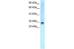 Human HepG2; WB Suggested Anti-EAP30 Antibody Titration: 5. (SNF8 antibody  (N-Term))