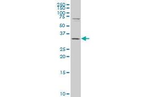 CBR3 polyclonal antibody (A01), Lot # 060124JC01. (CBR3 antibody  (AA 180-277))