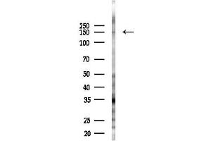 Western blot analysis of lysates from EC304 cells(starvation 24h treatment), using HDAC6 Antibody at 1/1000 dilution.