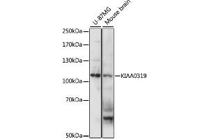 Western blot analysis of extracts of various cell lines, using KIAA0319 antibody (ABIN6290542) at 1:1000 dilution. (KIAA0319 antibody)