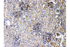 Immunohistochemistry (IHC) image for anti-Tumor Necrosis Factor Receptor Superfamily, Member 10b (TNFRSF10B) (AA 233-440) antibody (ABIN5518794)