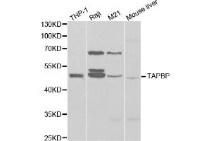 Western Blotting (WB) image for anti-TAP Binding Protein (Tapasin) (TAPBP) antibody (ABIN1875423)