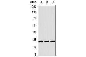 Western blot analysis of Tumstatin expression in HepG2 colchicine-treated (A), HeLa UV-treated (B), Raw264.