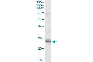 ARHGDIB MaxPab rabbit polyclonal antibody. (ARHGDIB antibody  (AA 1-201))