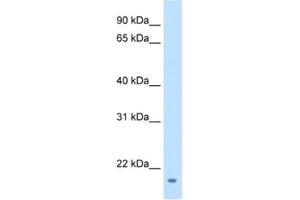 Western Blotting (WB) image for anti-Family with Sequence Similarity 107, Member A (FAM107A) antibody (ABIN2462571)
