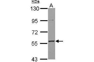 AF9 antibody  (Center)