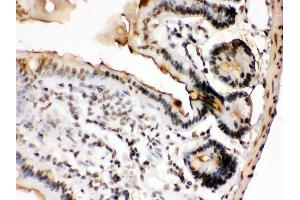 Immunohistochemistry (Paraffin-embedded Sections) (IHC (p)) image for anti-FBJ Murine Osteosarcoma Viral Oncogene Homolog B (FOSB) (AA 264-291), (C-Term) antibody (ABIN3042399) (FOSB antibody  (C-Term))