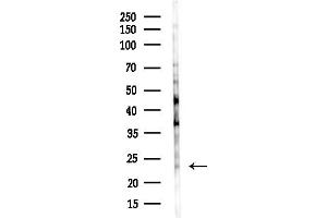 Western blot analysis of lysates from Rat liver, using AKAP14 Antibody at 1/1000 dilution.